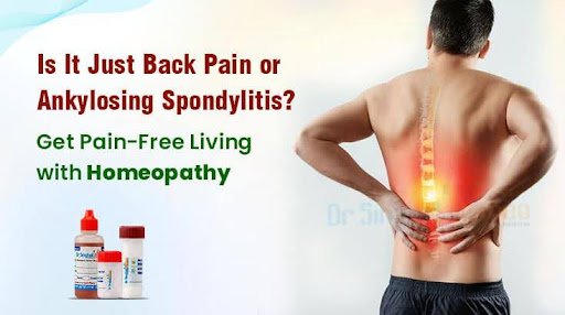 Living With Ankylosing Spondylitis? Here We Bring You the Benefits of Homeopathy for a Healthy Spine & a Symptom-Free Life!