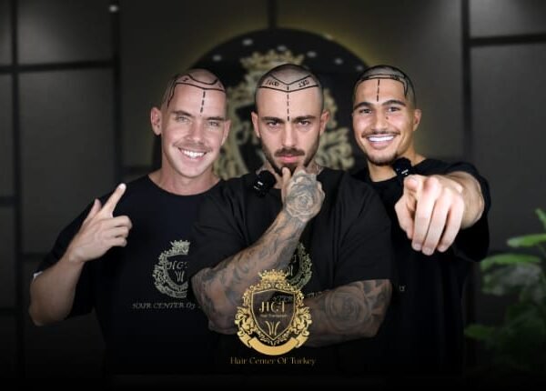 Top 10 Hair Transplant Clinics in Turkey 2026